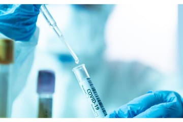 Phuket COVID-19 PCR Test with Fit to Fly Certificate